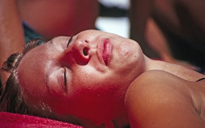 Don’t Look Like A Beetroot. A Few Secret Sunburn Hacks